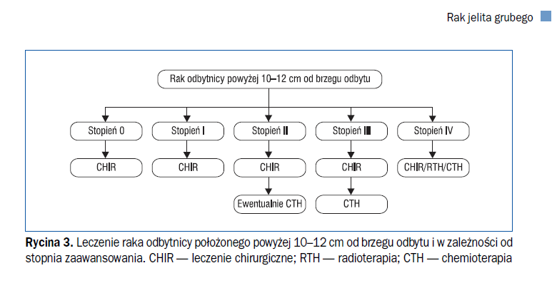 leczenie raka odbytnicy - obrazek